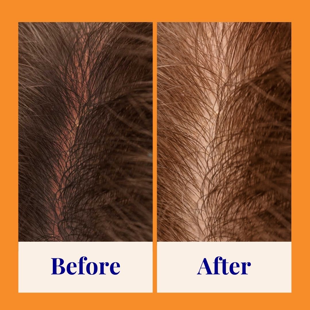 6_-_Lifestyle_-_2_47oz_Strengthening_Shampoo_jpg.jpg