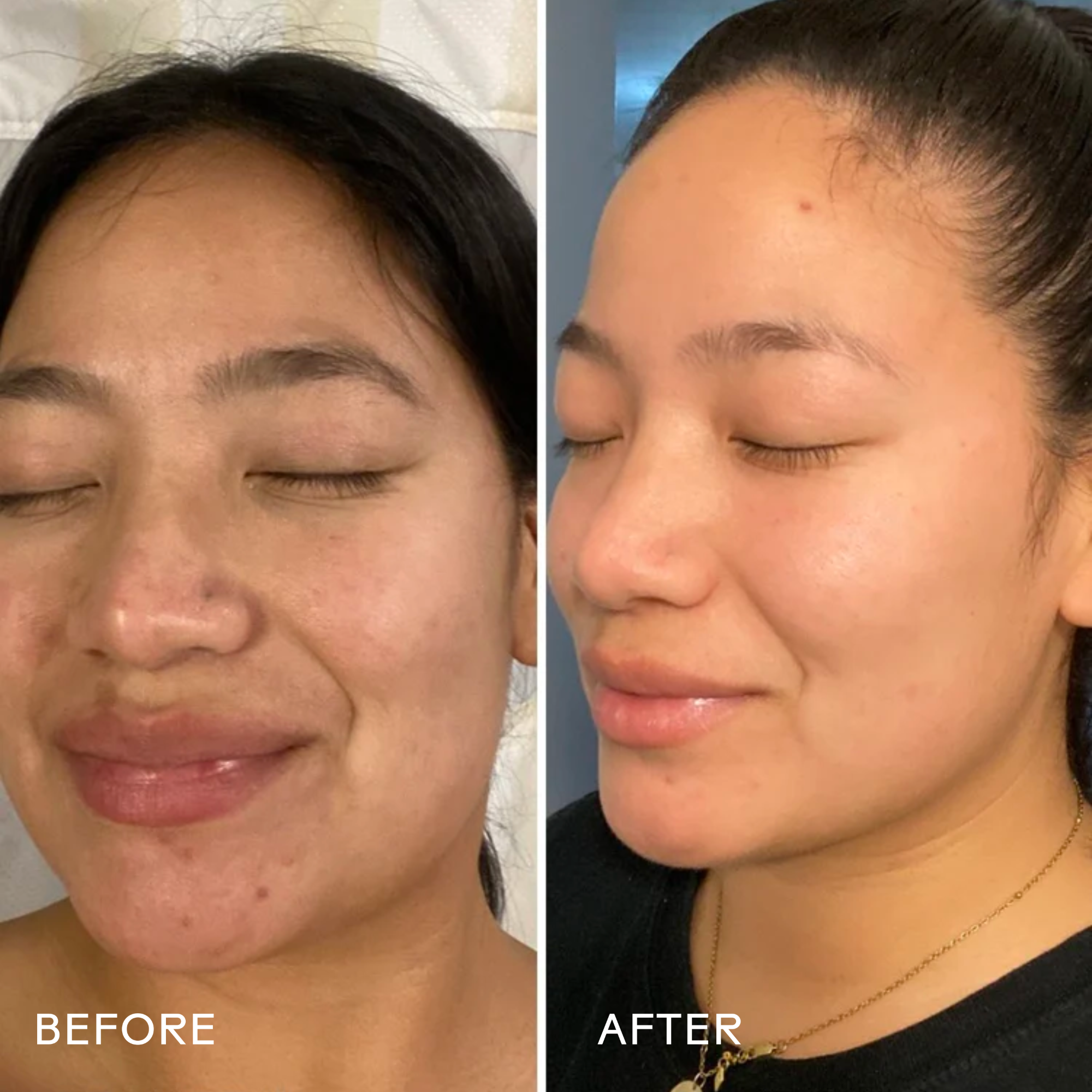 DreamBio-Retinol_ShoreaButterRejuvenatingCream_628110639462_B_A.png