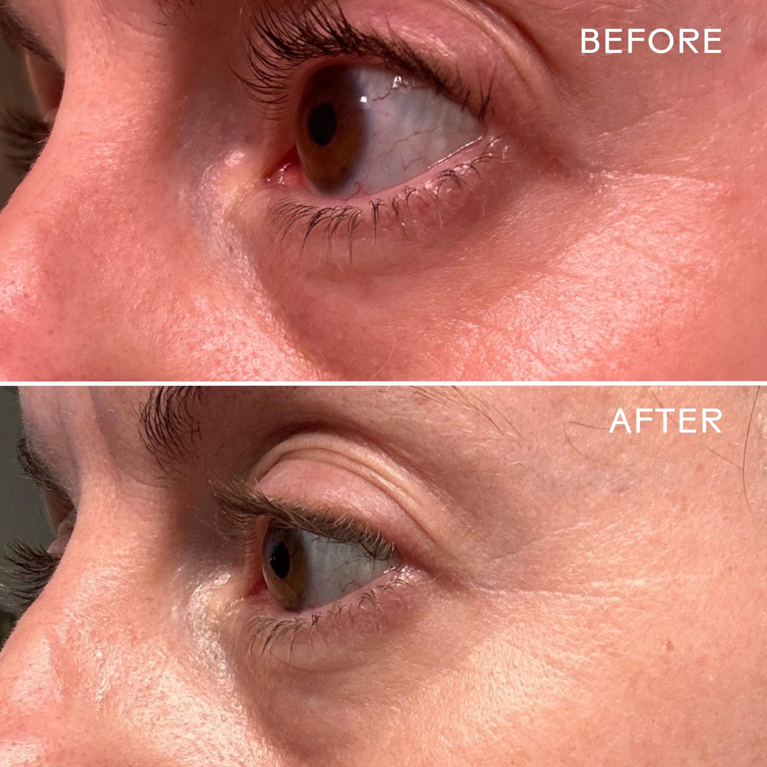 EyeHeroBio-RetinolSmoothingEyeCream_628110639530_B_A-1.jpg