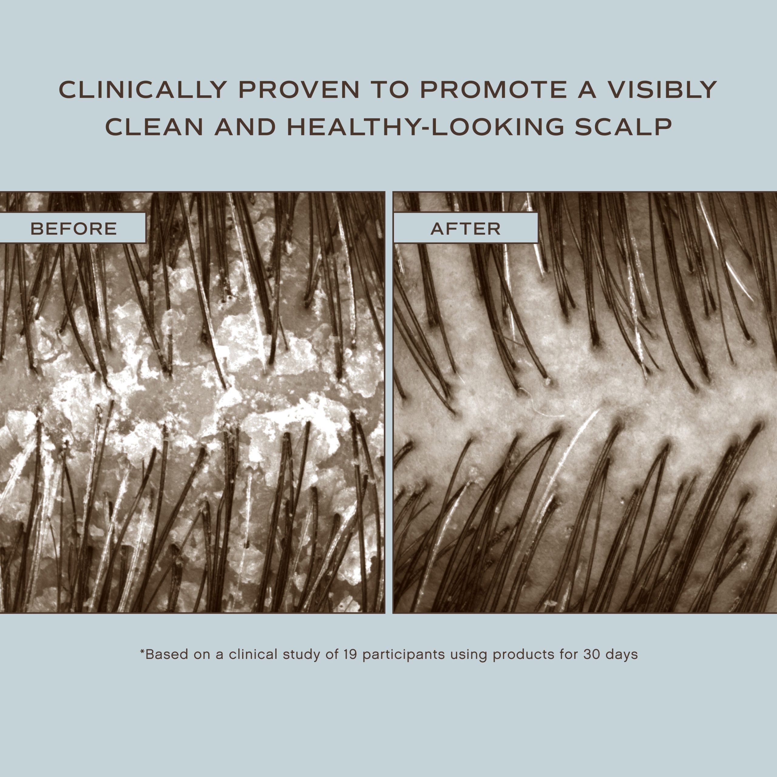 Innersense_HairRenewScalpHairbath_BeforeAndAfter.jpg