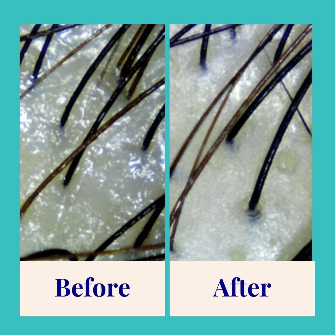 ThePowderShampoo_PurifyingPowderShampoo_Peppermint_Lifestyle2.jpg